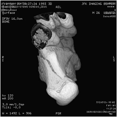 DICOM Image Sample Screenshot