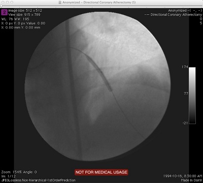 DICOM Window Width/Level Screenshot