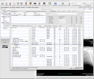 Osirix Query Retreive